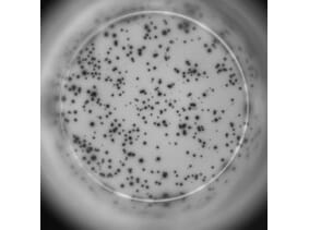 ELISpot - Human IL-2 ELISpot Kit (A334655) - Antibodies.com