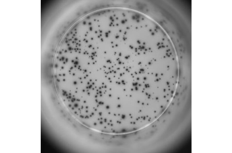ELISpot - Human IL-2 ELISpot Kit (A334655) - Antibodies.com