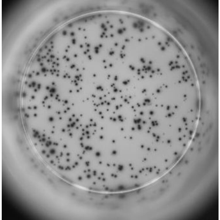 ELISpot - Human IL-2 ELISpot Kit (A334655) - Antibodies.com