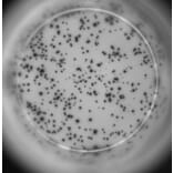 ELISpot - Human IL-2 ELISpot Kit (A334655) - Antibodies.com