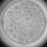 ELISpot - Human IL-10 ELISpot Kit (A334657) - Antibodies.com