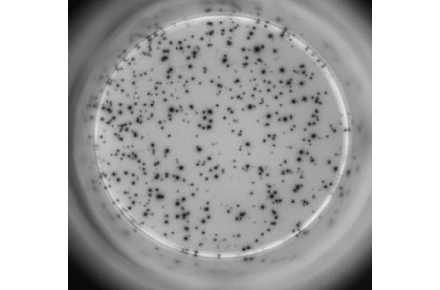 ELISpot - Human IL-17A ELISpot Kit (A334658) - Antibodies.com