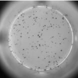 ELISpot - Human TNF alpha ELISpot Kit (A334659) - Antibodies.com