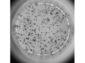 ELISpot - Mouse IL-4 ELISpot Kit (A334662) - Antibodies.com