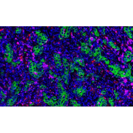 mIHC - mIHC Complete TSA Multiplex Kit - 3 Color- Antibodies.com