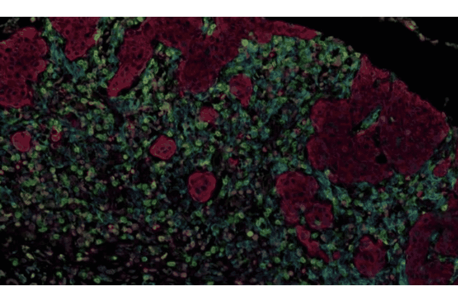 mIHC - mIHC Complete TSA Multiplex Kit - 3 Color- Antibodies.com