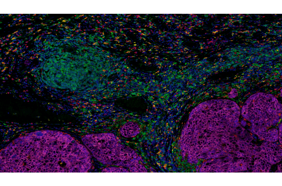 mIHC - mIHC Complete TSA Multiplex Kit - 5 Color (A334670) - Antibodies.com
