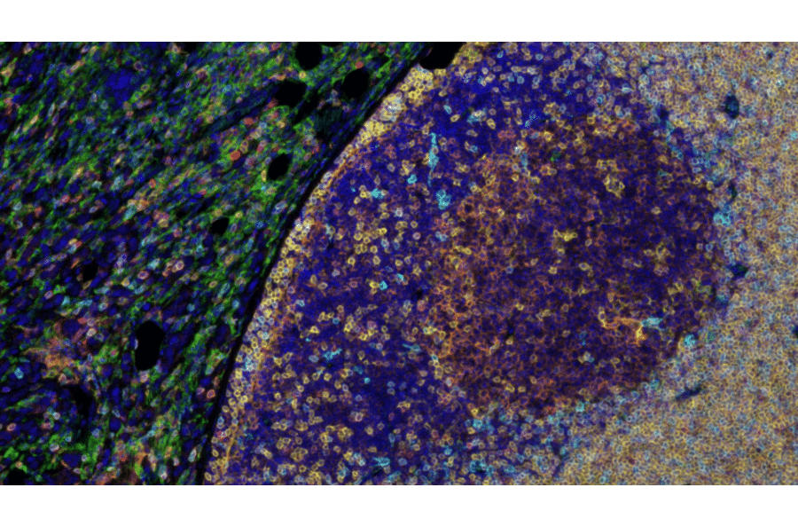 mIHC - mIHC Complete TSA Multiplex Kit - 5 Color (A334671) - Antibodies.com