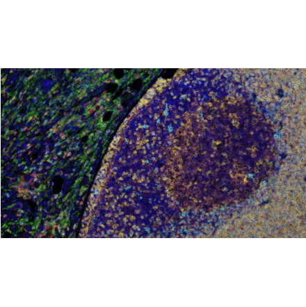 mIHC - mIHC Complete TSA Multiplex Kit - 5 Color (A334671) - Antibodies.com