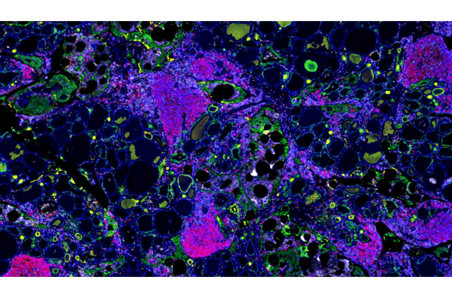 mIHC - mIHC Complete TSA Multiplex Kit - 6 Color (A334672) - Antibodies.com