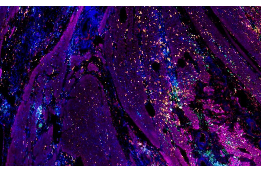 mIHC - mIHC Complete TSA Multiplex Kit - 5 Color (A334676) - Antibodies.com