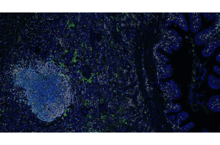 mIHC - mIHC Complete TSA Multiplex Kit - 6 Color (A334677) - Antibodies.com