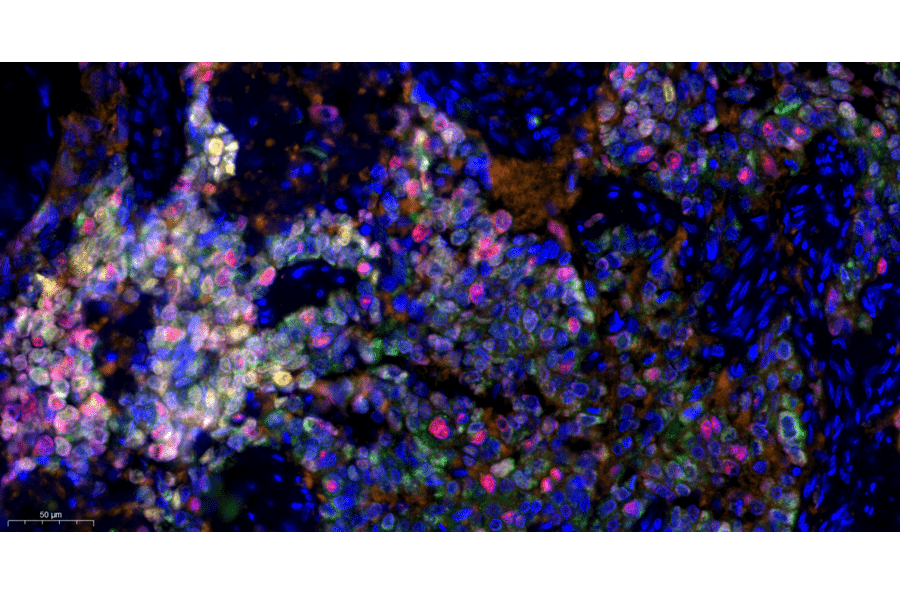 mIHC - mIHC Complete TSA Multiplex Kit - 6 Color (A334689) - Antibodies.com