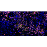 mIHC - mIHC Lung Cancer TME Panel I - 5 Color (A334690) - Antibodies.com