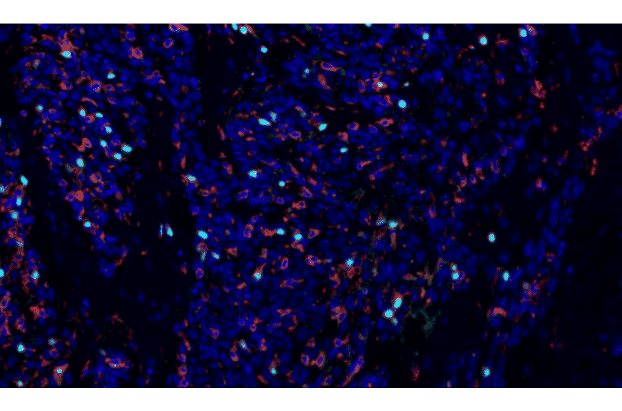 mIHC - mIHC Lung Cancer TME Panel II - 5 Color (A334693) - Antibodies.com