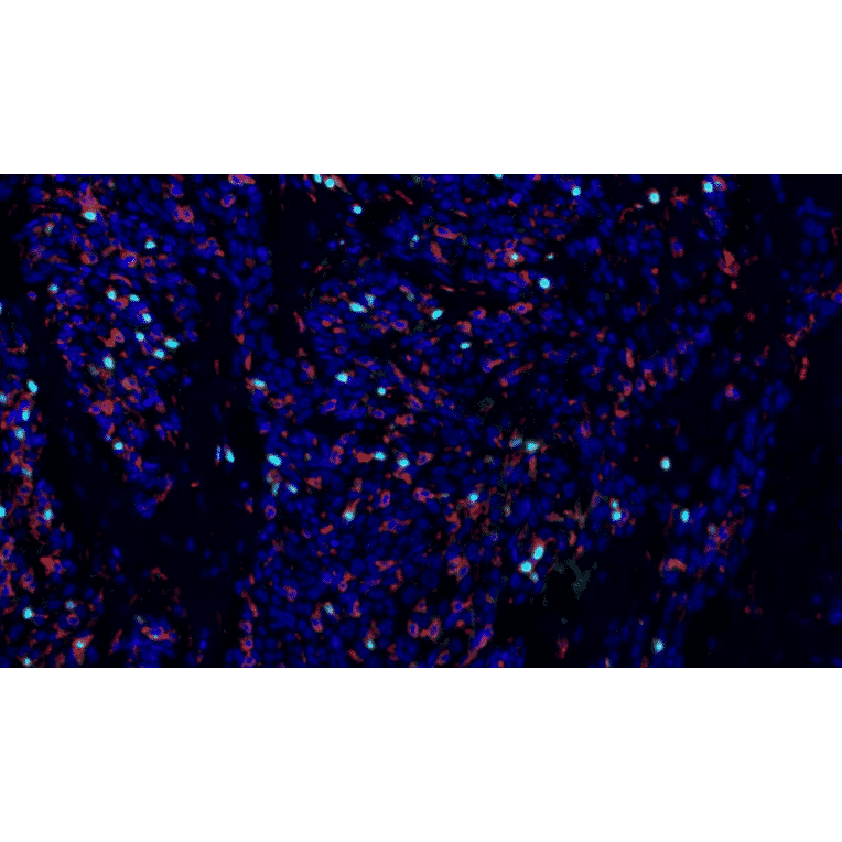 mIHC - mIHC Lung Cancer TME Panel II - 5 Color (A334693) - Antibodies.com
