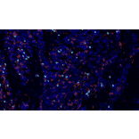 mIHC - mIHC Lung Cancer TME Panel II - 5 Color (A334693) - Antibodies.com