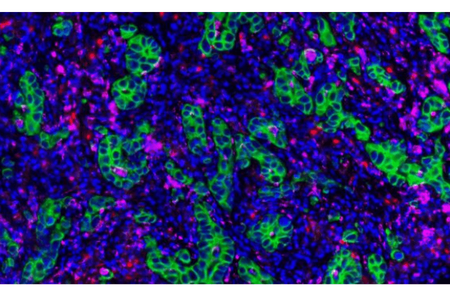 mIHC - mIHC Complete TSA Multiplex Kit - 3 Color B- Antibodies.com