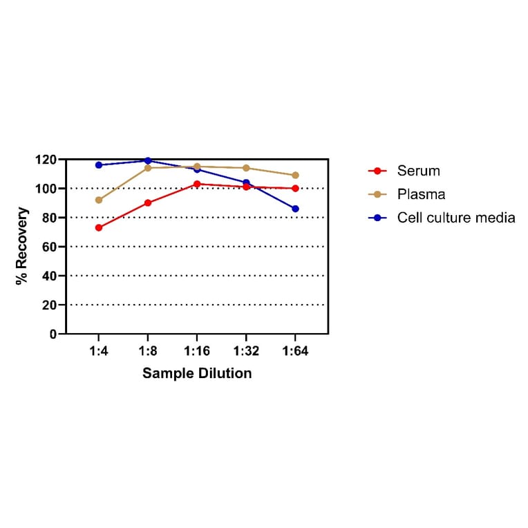 ELISA - Human IgE ELISA Kit (A334815)- Antibodies.com
