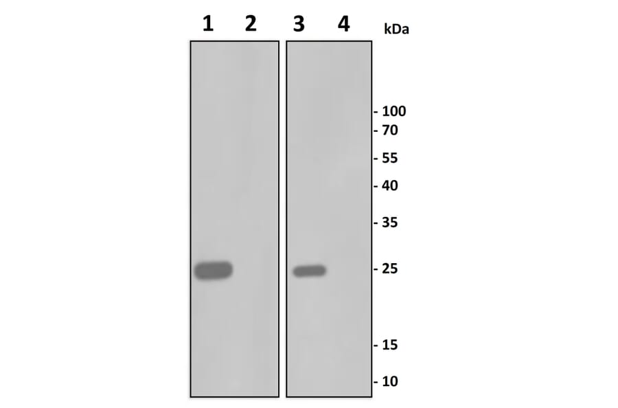 TNF alpha Antibody KO Validation - Human TNF alpha ELISA Kit (A334947) - Antibodies.com