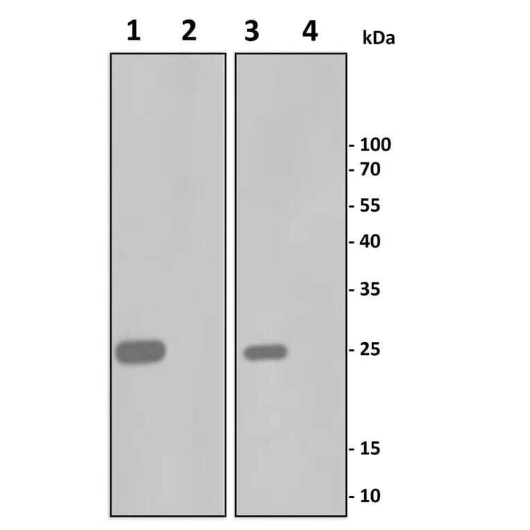 TNF alpha Antibody KO Validation - Human TNF alpha ELISA Kit (A335601) - Antibodies.com