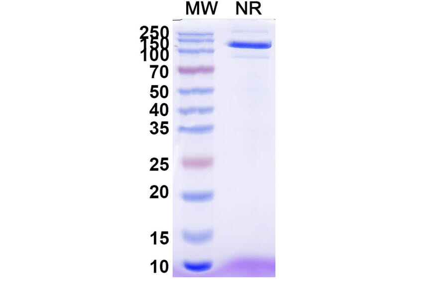 SDS-PAGE - Anti-EPEA Tag Nanobody [SAA0356] (A337466) - Antibodies.com