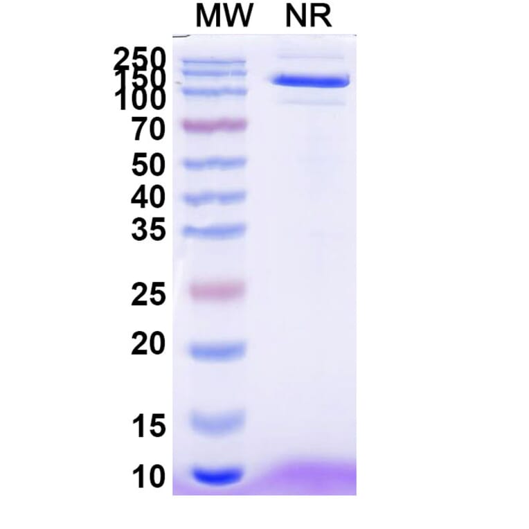 SDS-PAGE - Anti-EPEA Tag Nanobody [SAA0356] (A337466) - Antibodies.com
