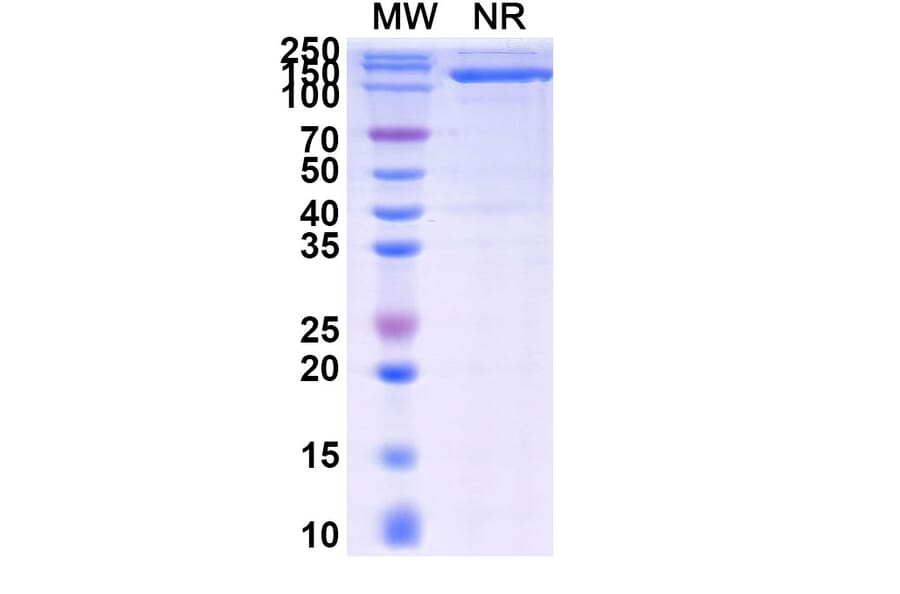 SDS-PAGE - Anti-IgG1 Fc Fragment Nanobody [SAA0489] (A337470) - Antibodies.com