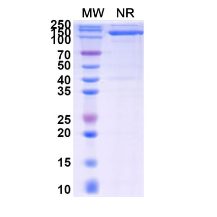 SDS-PAGE - Anti-IgG1 Fc Fragment Nanobody [SAA0489] (A337470) - Antibodies.com