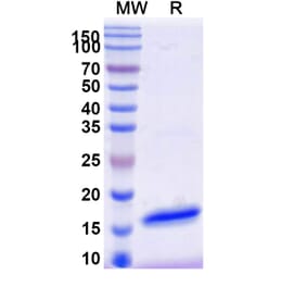 SDS-PAGE - Anti-GFP Nanobody [SAA1151] (A337473) - Antibodies.com