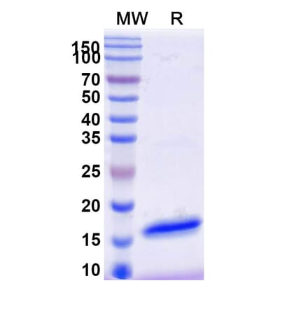 SDS-PAGE - Anti-GFP Nanobody [SAA1151] (A337473) - Antibodies.com