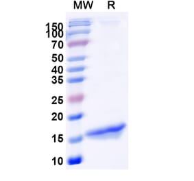 SDS-PAGE - Anti-GFP Nanobody [SAA0975] (A337476) - Antibodies.com