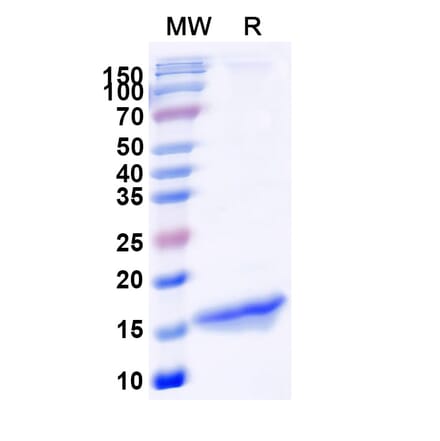 SDS-PAGE - Anti-GFP Nanobody [SAA0975] (A337476) - Antibodies.com