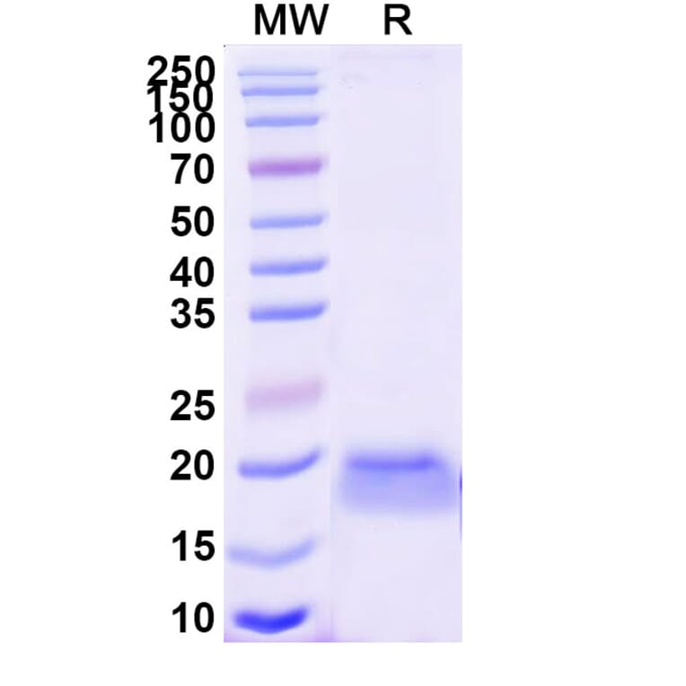 SDS-PAGE - Anti-mCherry Nanobody [SAA0879] (A337478) - Antibodies.com