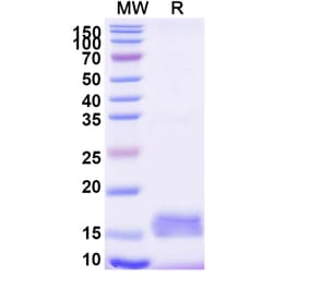 SDS-PAGE - Anti-mCherry Nanobody [SAA1128] (A337479) - Antibodies.com