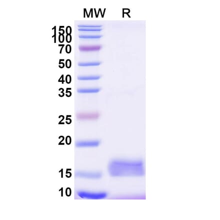 SDS-PAGE - Anti-mCherry Nanobody [SAA1128] (A337479) - Antibodies.com