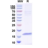 Dose-response - Anti-GST 26 Nanobody [SAA1199] (A337480) - Antibodies.com
