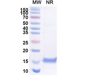 SDS-PAGE - Anti-beta Catenin Nanobody [SAA1411] (A337483) - Antibodies.com