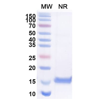 SDS-PAGE - Anti-beta Catenin Nanobody [SAA1411] (A337483) - Antibodies.com