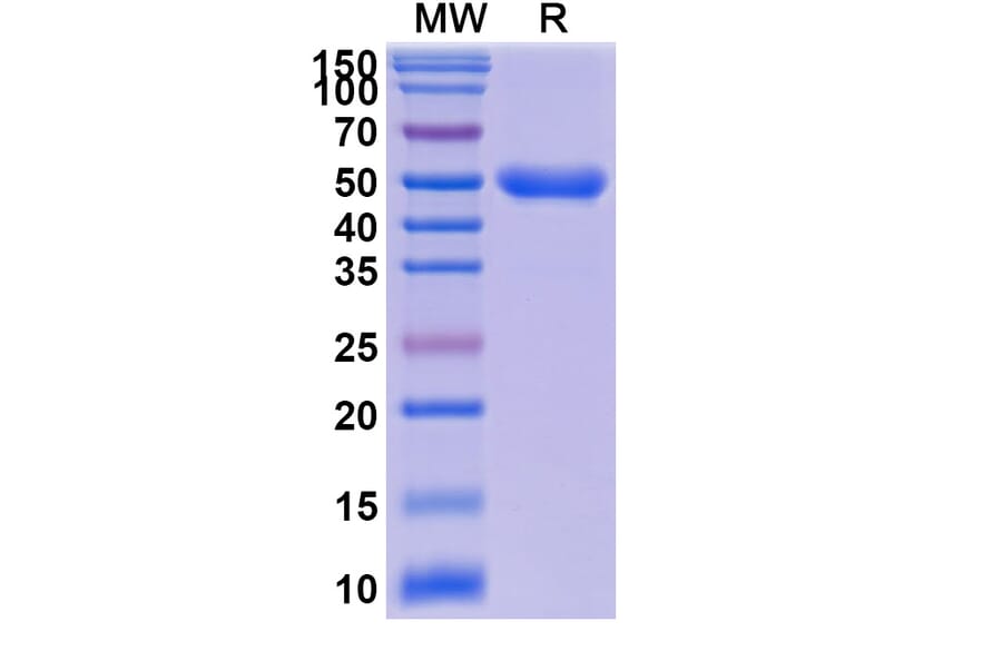 SDS-PAGE - Anti-ROR1 Nanobody [P3A1] (A337491) - Antibodies.com