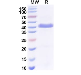 SDS-PAGE - Anti-Surfactant Protein A Nanobody [SAA2226] (A337492) - Antibodies.com