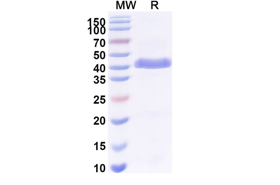 SDS-PAGE - Anti-Surfactant Protein A Nanobody [SAA2226] (A337492) - Antibodies.com