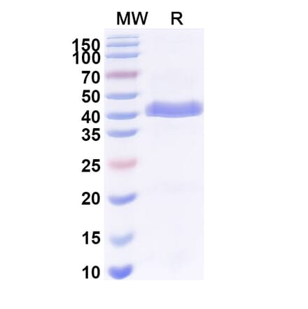 SDS-PAGE - Anti-Surfactant Protein A Nanobody [SAA2226] (A337492) - Antibodies.com