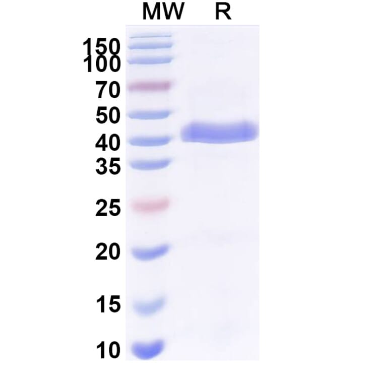 SDS-PAGE - Anti-Surfactant Protein A Nanobody [SAA2226] (A337492) - Antibodies.com
