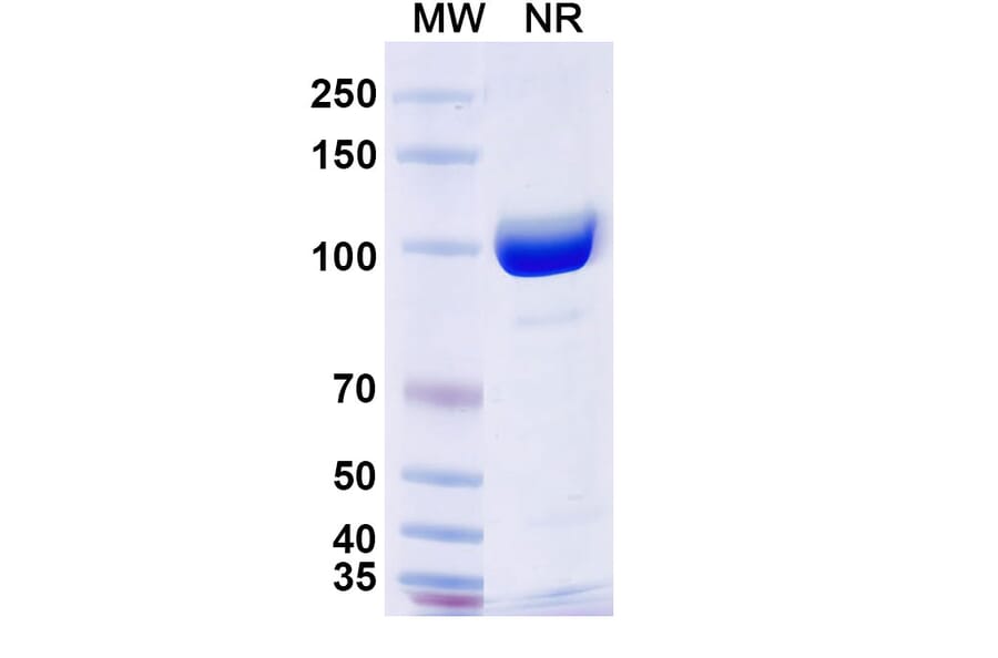 SDS-PAGE - Anti-Surfactant Protein A Nanobody [SAA2226] (A337492) - Antibodies.com