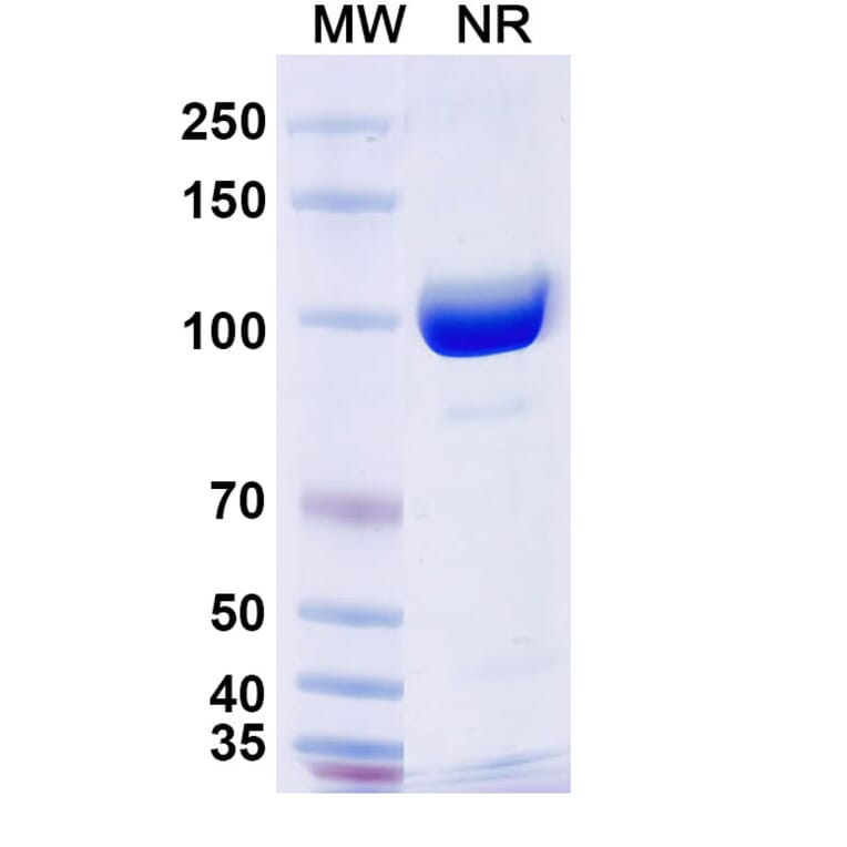 SDS-PAGE - Anti-Surfactant Protein A Nanobody [SAA2226] (A337492) - Antibodies.com