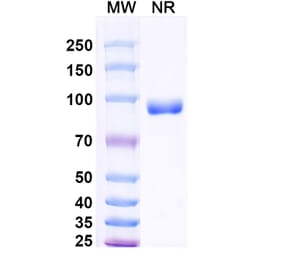SDS-PAGE - Anti-Surfactant Protein A Nanobody [SAA2227] (A337493) - Antibodies.com