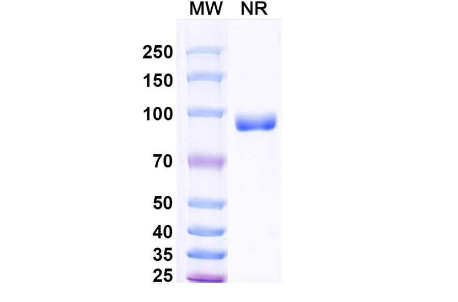 SDS-PAGE - Anti-Surfactant Protein A Nanobody [SAA2227] (A337493) - Antibodies.com