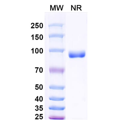 SDS-PAGE - Anti-Surfactant Protein A Nanobody [SAA2227] (A337493) - Antibodies.com