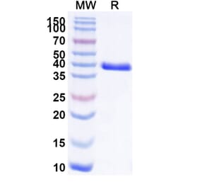 SDS-PAGE - Anti-CEACAM6 Nanobody [L-DOS-47] (A337495) - Antibodies.com